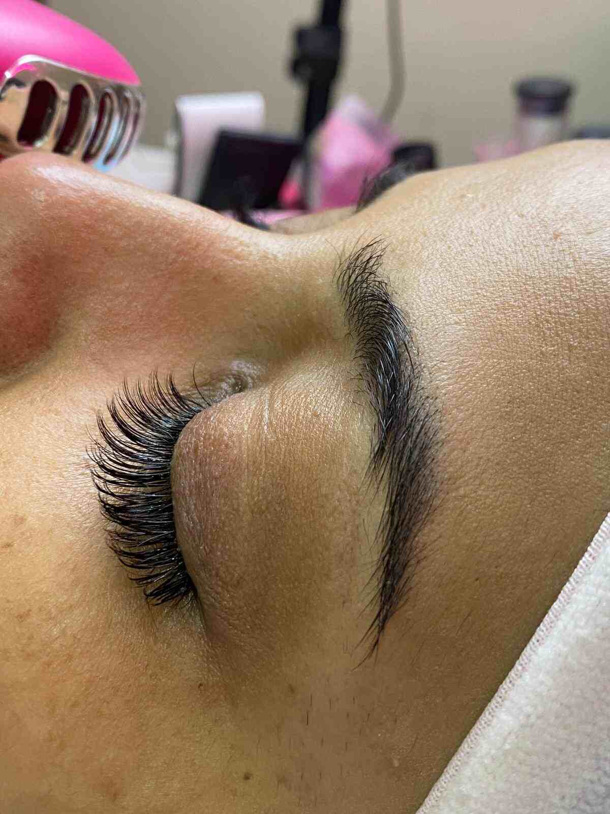 Beauty treatment result