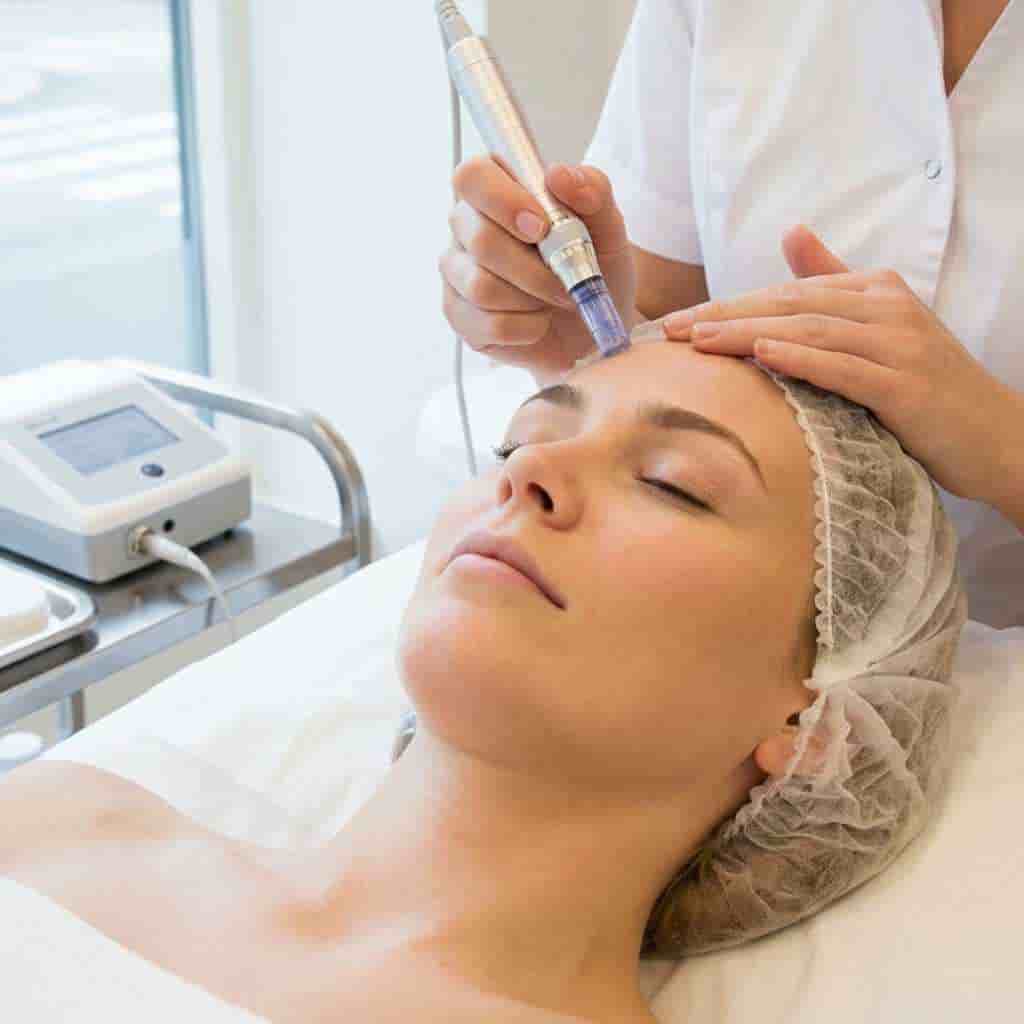 Dermapen ansiktsbehandling hos BeautyCorner Oslo